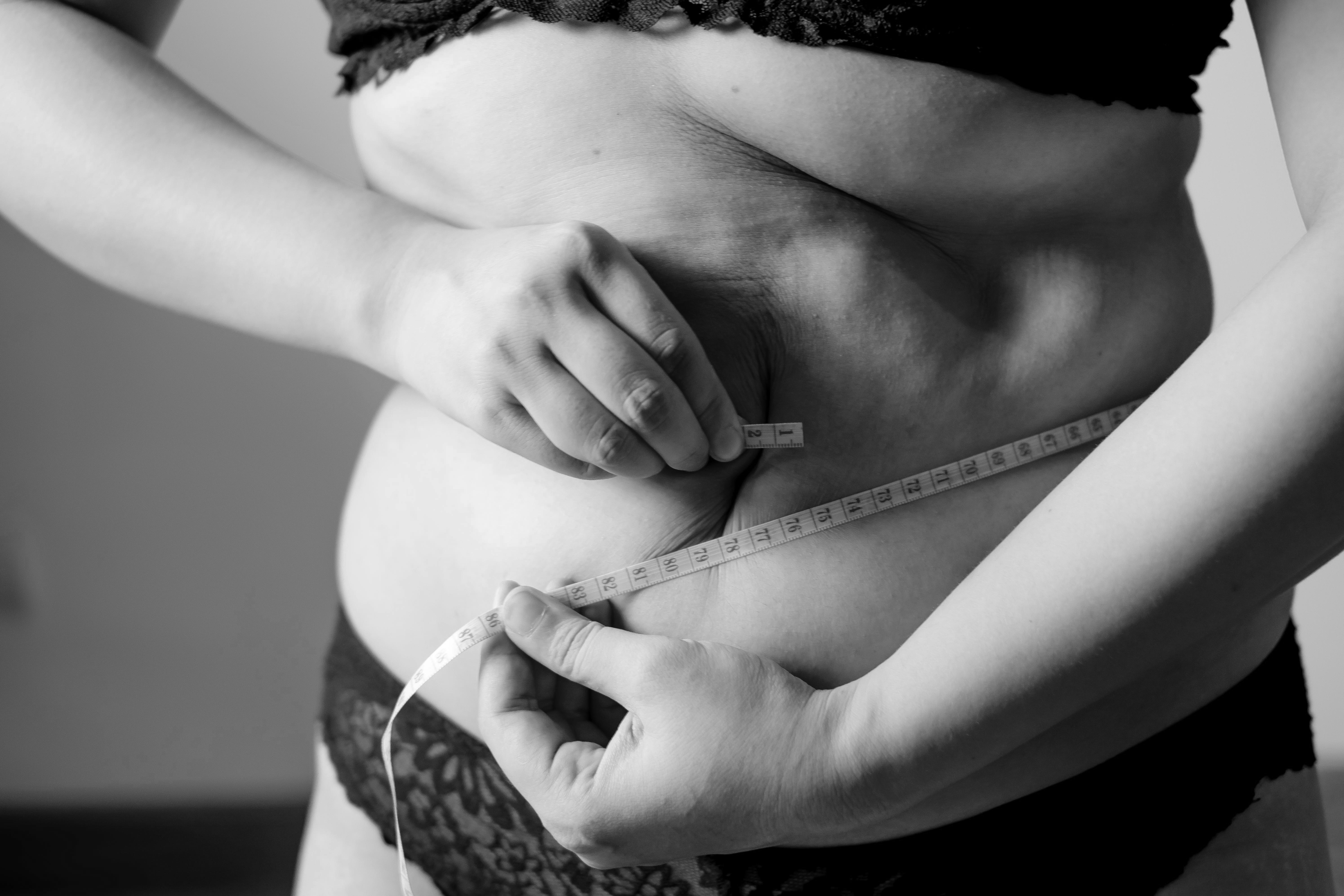 Weight Loss Solutions